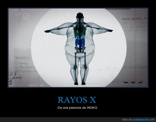 ser_de_hueso_ancho_ya_no_es_excusa